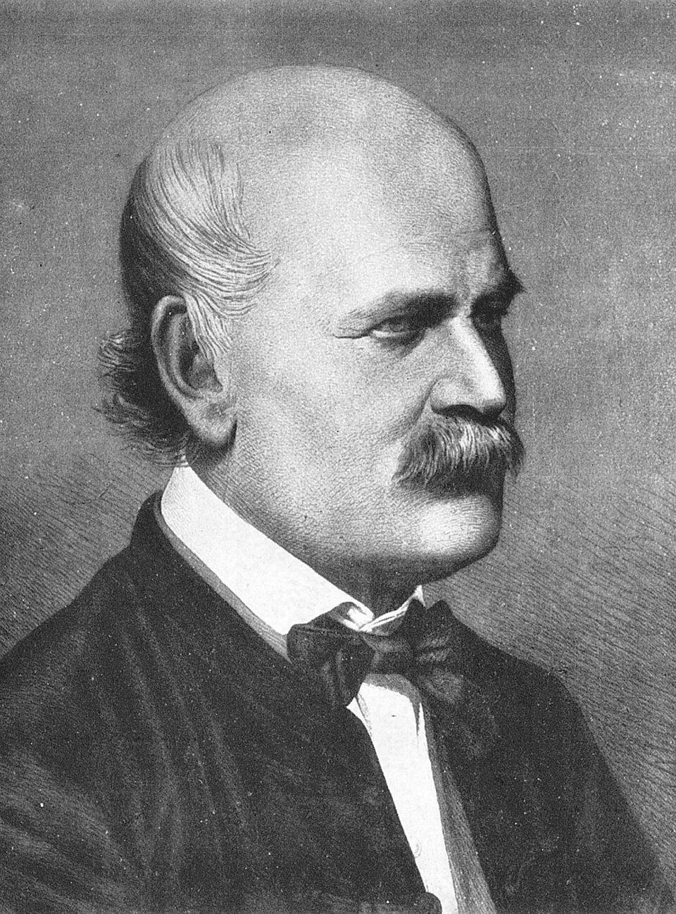 Portrait of Ignaz Semmelweis, 1860
