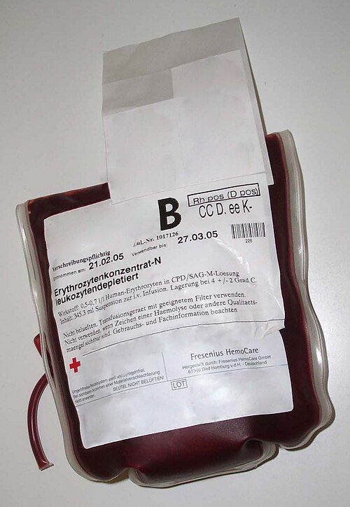 Bag of concentrated red blood cells prepared for transfusion