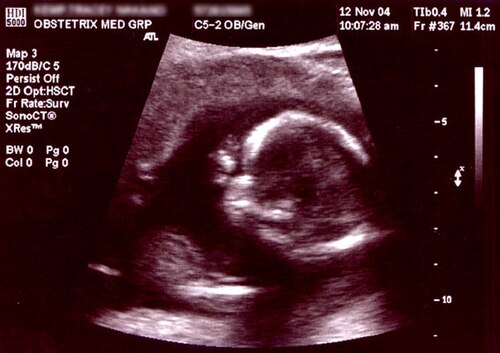 Clinician performing an obstetric ultrasound examination