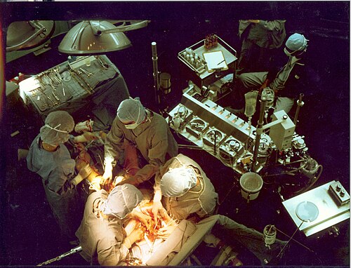 Illustration of coronary artery bypass graft surgery