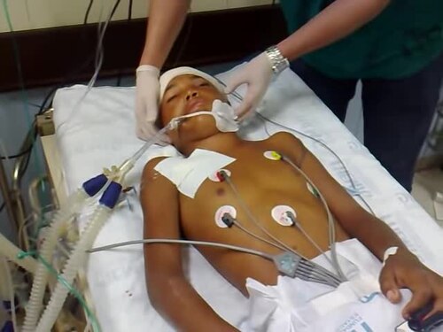 Clinical illustration related to brain death