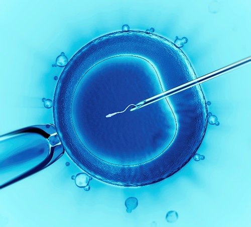 Illustration of the in vitro fertilisation procedure