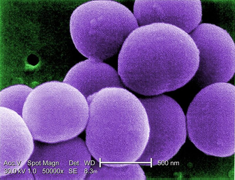 Staphylococcus aureus bacteria under a scanning electron microscope