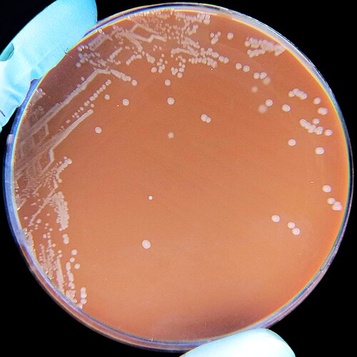 Micrograph of Haemophilus influenzae bacteria