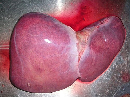 Liver transplantation surgery