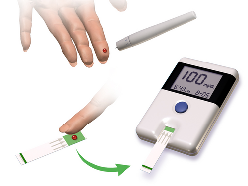 Blood glucose monitoring device