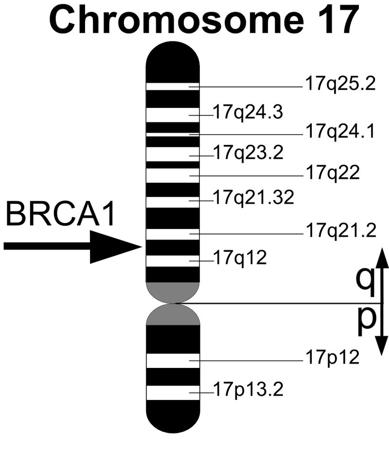Diagram of chromosome 17 showing where the BRCA1 gene lies