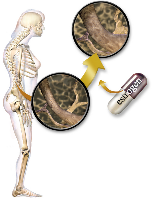 Illustration representing menopausal hormone replacement therapy