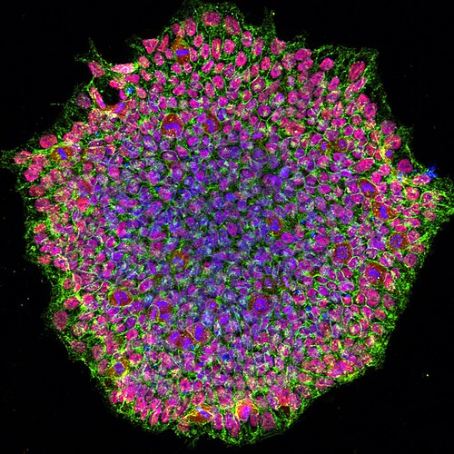 Colony of human induced pluripotent stem cells in culture