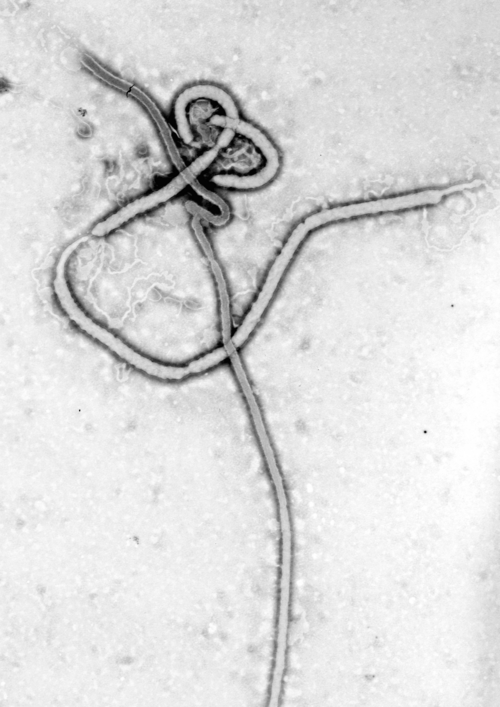 Electron micrograph of Ebola virus, the pathogen targeted by the rVSV-ZEBOV (Ervebo) vaccine