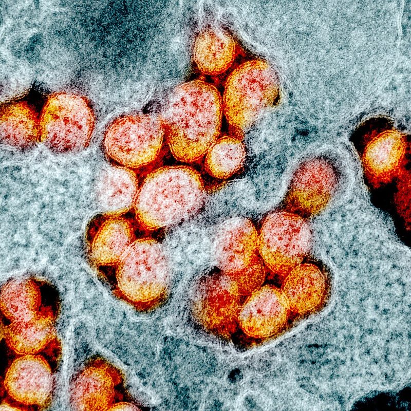 Colorized electron micrograph of SARS-CoV-2 virus particles