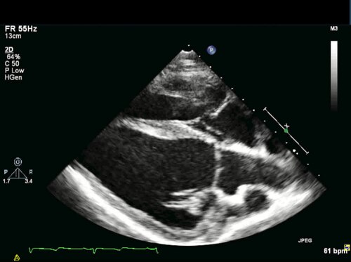 Medical imaging illustrating xenotransplantation research, the transplantation of animal organs into humans