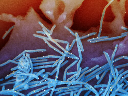 Electron micrograph of respiratory syncytial virus particles, the pathogen prevented by nirsevimab